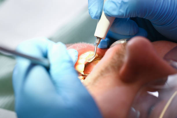 Tooth Infection Emergency Dentist in WA